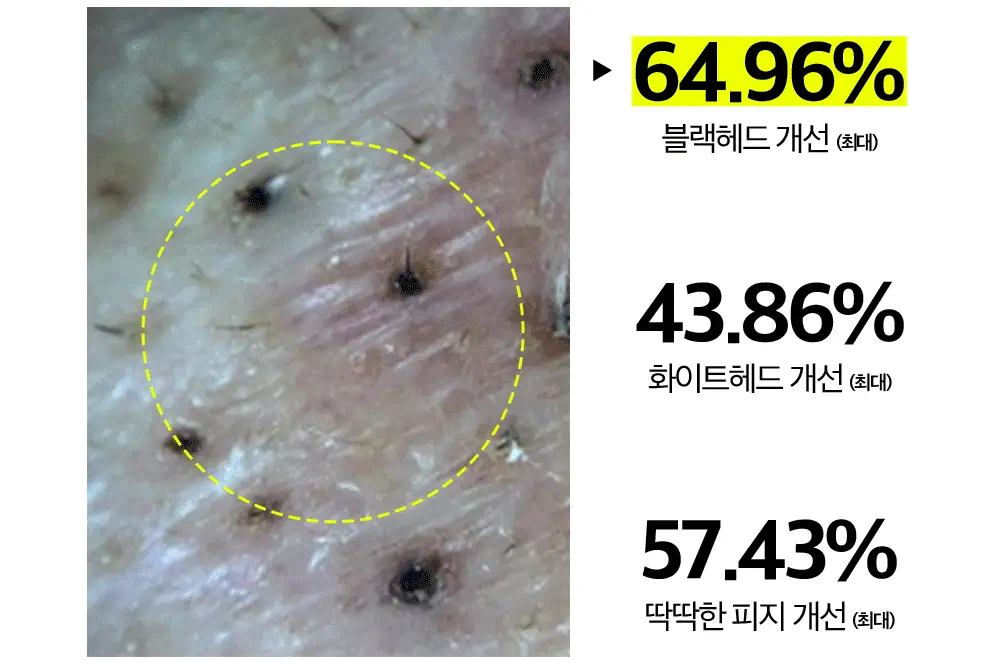 [각질패드/모공청정] 비플레인 녹두 모공 클리어링 필터 패드 70매 상세페이지 14